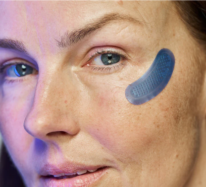 Micro-Infusion Targeted Patches