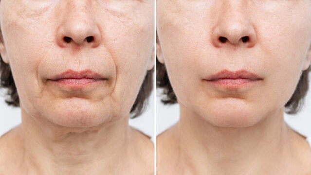 Dermora Advanced Api-Lift Complex™ for a visibly firmer-looking and radiant skin in just 2 weeks