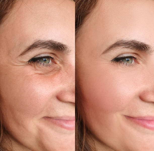 Dermora Advanced Api-Lift Complex™ for a visibly firmer-looking and radiant skin in just 2 weeks
